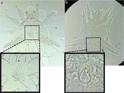 Figure 4. Chaetodactylus krombeini female (a) and male (b) adults were cleared, and slide mounted in PVA mounting medium (100×). Genitalia are distinct on the ventral side of both sexes, with a cleavage-like oviporus present on females and a dark coloured aedeagus present on males.
