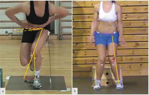 Figure 2. The single-leg squat (a) and the vertical drop jump (b) tests, visually presenting the calculation of the lateral pelvic tilt (LPT) and frontal plane projection angle (FPPA) in 2A, and the medial knee position (MKP) in 2B. The FPPA angle and Medial Knee Position seen in these athletes would have a negative sign due to the valgus joint position.