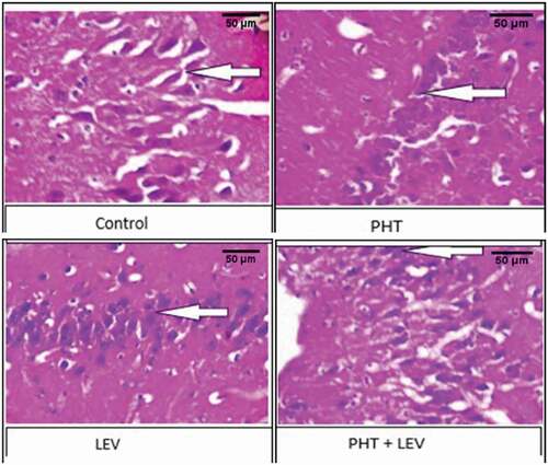 Figure 8. The histomorphology of cerebellum following PHT, LEV and PHT+ LEV adjunctive treatment in male Wistar rats