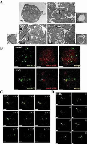 Figure 2. Autophagosome formation in H2O2-activated human platelets. (A) Representative transmission electron microscopic images of platelets treated (ii–iv) with or (I) without 100 μM H2O2 for 60 min. The arrowhead indicates the double-membrane autophagosome (ii) and the arrows indicate the early (iii) and late (iv) autophagosome enveloping mitochondria. Scale bar: 0.5 μm. (B) Washed platelets treated with or without 100 μM H2O2 for 60 min and then fixed. The LC3 and lysosomes were stained with anti-LC3 and anti-LAMP1 antibodies, respectively. These images were observed under a deconvolution microscope and were also captured from 2D (x-y axis). Three-dimensional (3D) autophagosome–lysosome fusion (i.e., autolysosome) was also provided in video form in Video S1. The green and red colors indicate LC3 and lysosomes, respectively. The white arrowhead indicates colocalization of LC3 and lysosome. Scale bar: 0.7 µm. (C) Different z-sections (z-axis) of the merged image of H2O2-treated platelets in (B). Scale bar: 0.7 µm. (D) Different angles (rotation) of the merged image of H2O2-treated platelets in (B). Scale bar: 0.7 µm. The profiles (A-D) are representative examples of 4 similar experiments