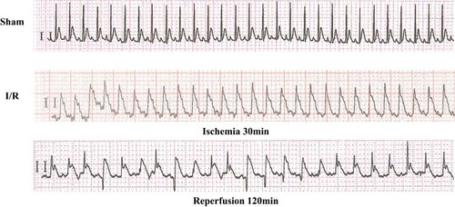 Figure 1 Changes in the ECG when the rat I/R model was established.