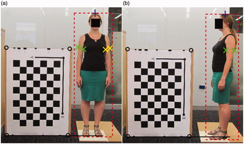 Figure 5. Images showing the positioning of the subject and digital marker placement in Liu et al. [Citation56].