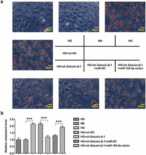 Figure 6. Downregulation of Salusin-β impeded lipid accumulation in HG-induced HK-2 cells by suppressing miR-155-5p. (a) Oil red O staining of the intracellular lipid droplet. (b) Relative TG concentrations