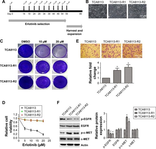 Figure 1 c-MET is overactivated in erlotinib-resistant tongue cancer cells (TCA8113).