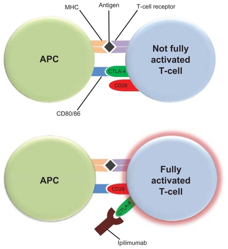 Figure 1 Ipilimumab blocks the costimulatory signal required for T-cell activation. Antigen-presenting cells (APCs) present melanoma antigens bound to the major histocompatibility complex (MHC) to T-cells. Costimulation of CD28 receptor on T-cells by CD80 or CD86 ligands on APCs is also required for optimal T-cell activation. The cytotoxic T-lymphocyte antigen-4 (CTLA-4) on T-cells can bind with greater affinity to CD80 and CD86, and thus disrupt the necessary costimulatory signal provided by APCs. Ipilimumab binds to CTLA-4 and blocks its binding to CD80 or CD86 on APCs allowing for costimulation of CD28 receptors on T-cells by APC CD80/86, and optimal T-cell activation.Citation9,Citation10