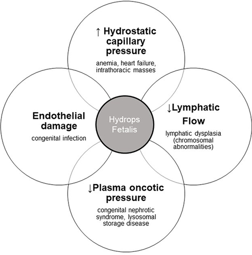 Figure 2 Contributing mechanisms to hydrops fetalis and examples of etiologies. For any given etiology, a specific mechanism may predominate but all mechanisms operate interconnectedly.