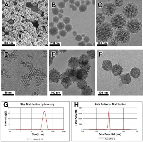 Figure 2 The structural characterization of the samples.Notes: (A) SEM image of MSN. (B, C) TEM images of MSN. (D, E, F) TEM images of the Fe3O4 nanocrystals, MMSN, and nanocomposite. (G) Particle size of the MSN determined by DLS. (H) Zeta potential of the MSN determined by DLS.Abbreviations: TEM, transmission electron microscope; SEM, scanning electron microscope; DLS, dynamic light scattering; MMSN, magnetic mesoporous silica nanoparticle.