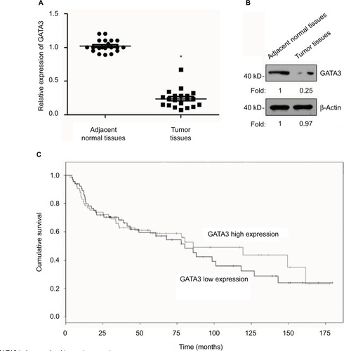 Figure 1 GATA3 is downregulated in gastric cancer tissues.