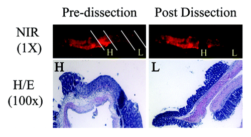 Figure 3. NIR-imaging identifies inflammatory hot spots of the colon of male mice with DSS-induced IBD.The colon of male mice injected with ProSense680 was used for ex vivo optical NIR-imaging. Areas with high (H) and low (L) NIR-signal was micro-dissected from the surrounding tissue, fixed in paraformaldehyde and subjected for histology. H/E staining reveal that hot spots with high (H) NIR-signal show increased epithelial atrophy compared to areas with low (L) NIR-signal.