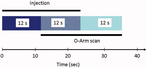 Figure 2. Contrast injection protocol. For image acquisition, a 24 s scan was used (‘high definition mode’ or ‘enhanced cranial mode’ of the Medtronic O-arm). Fluoroscopy was started with a delay of 12 s after contrast injection was started. This delay was calculated to be the approximate circulation time of the contrast agent administered via a central venous catheter until it appears in the cerebral circulation.