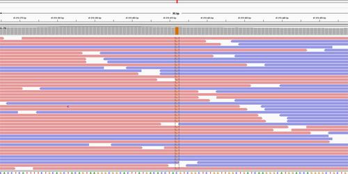 Figure S1 Image of Chr17 variant (GRCh38):g.41818412C>G seen by NGS.Abbreviation: NGS, next-generation sequencing.