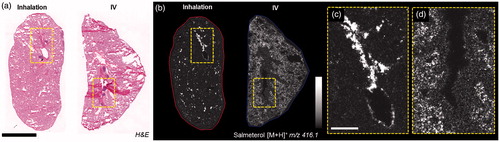 Figure 2. (a) H&E staining of inhaled and IV dosed lung sections. (b) MALDI images of corresponding tissues at 35 µm spatial resolution showing the differential distribution of salmeterol depending on administration route (duplicate biological and technical replicates). Inhaled salmeterol was preferably retained in bronchioles whereas systemic dose was more widely detected within tissue 30 min after delivery. (c and d) Higher magnification of a bronchiolar area in both conditions, the different administration routes clearly display differential distribution. Intensity scale 0–100%. Scale bars = 5 mm (black)/1 mm (white).