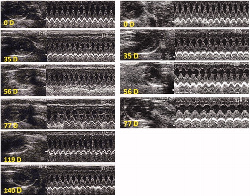 Figure 7. Echocardiography in one rat treated with DOX (right) and another with saline (left). B mode is shown at left and M mode at right. 0D indicates the day before treatment. Note that on day 56D and 77D, a rat treated with DOX exhibited increased left ventricular internal diameter in systole (LVIDs) and distole (LVIDd), enlarged posteror wall thickness (PW) and decreased interventricular septum thickness.