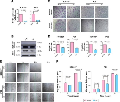 Figure 3 Overexpression of MTBP promotes lung adenocarcinoma cells invasion and migration both in vitro and in vivo.