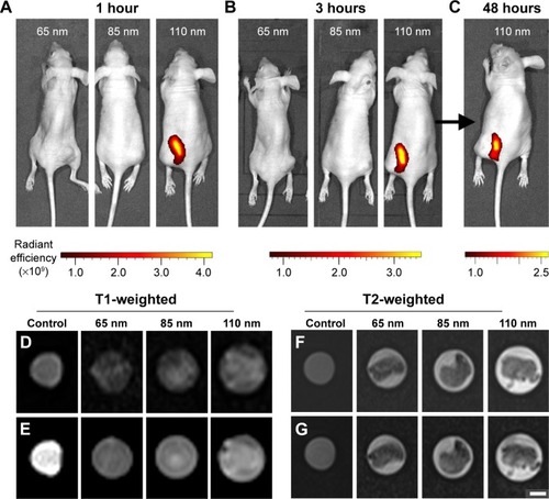 Figure 4 In vivo fluorescence and magnetic resonance imaging using the prepared multifunctional nanoparticles.Notes: Fluorescence images taken for tumor-bearing mice treated with (A) 65 nm, 85 nm, and 110 nm nanoparticles after 1 hour, (B) 65 nm, 85 nm, and 110 nm nanoparticles after 3 hours, and (C) with 110 nm nanoparticles after 48 hours. (D) T1-weighted spin-echo images of extracted tumors. (E) T1-weighted fat saturation spin-echo images of extracted tumors. (F) T2-weighted turbo spin-echo images of extracted tumors. (G) T2-weighted fat saturation turbo spin-echo images of extracted tumors. Control samples comprised of 1 mg/mL nanoparticle solutions. Radiant efficiency was measured using arbitrary units. Scale bar represents 150 μm for (B) and 400 mm for (D–G).