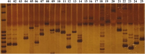 Figure 7. Electrophoresis of 25 pairs of SSR primers related to metabolism.