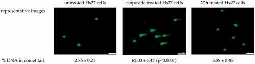 Figure 4. Genotoxic potential of the s-triazole 20b evaluated in a single cell gel electrophoresis assay. The compounds was tested at the concentrations equal to its IC50Tg. Etoposide (positive control) was tested at 10 μg/mL. Statistical significance was calculated using ANOVA analysis followed by Dunnett’ spost hoc test (vs. untreated cells).