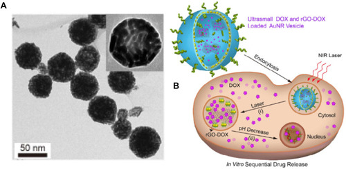 Figure 5 (A) rGO-AuNRVe morphology by TEM, (B) Dox release process from rGO-AuNRVe in the cell (Reproduced with permission).Note: Copyright ©2015. American Chemical Society. Reproduced from Song J, Yang X, Jacobson O, et al. Sequential drug release and enhanced photothermal and photoacoustic effect of hybrid reduced graphene oxide-loaded ultrasmall gold nanorod vesicles for cancer therapy. ACS nano. 2015; 9 (9): 9199–9209.Citation119