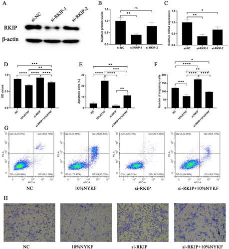 Figure 7. NYKF treatment inhibits hEM15A cells proliferation and migration and induces apoptosis by targeting RKIP. hEM15A cells were transfected with either si-RKIP or si-NC for 24 h, and then cultured with 10% NYKF-medicated mice serum, following which cells were harvested for subsequent experiments. Transection efficiency of si-RKIP was determined by western blot (A and B) and real-time PCR (C) in hEM15A cells. Cell proliferation was measured by CCK-8 (D). Apoptosis was measured by flow cytometry (E and G). Migration was measured by Transwell assay (F and H). NC: negative control. Data are shown as means ± SD (n = 3), and data between multiple groups were compared by one-way ANOVA. *p < .05, **p < .01, ***p < .001, ****p < .0001.