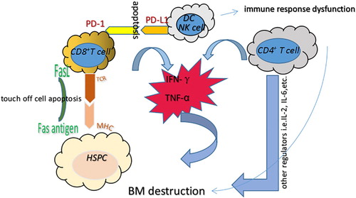 Figure 1 . Immune-mediated mechanism related to AA pathogenesis. AA is thought to be mediated by abnormally activated T lymphocytes and their secreted lymphokines, which subsequently result in HSC dysfunction and BM destruction. Overproduction of pro-inflammatory cytokines, including IFN-γ, TNF-α and other regulators, inhibits the hematopoietic system and leads to cell apoptosis through the Fas/FasL signaling pathway. In addition, IFN-γ could induce PD-L1 expression on T cells, NK cells and dendritic cells, which then binds to PD-1 to induce apoptosis and reduce immune tolerance. DC: dendritic cell; HSC: hematopoietic stem cell; IFN-γ: interferon-γ; TNF-α: tumor necrosis factor-α.