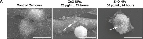 Figure 7 ZnO NPs induced HaCaT cell apoptosis.Notes: (A) Scanning electron microscopy images of HaCaT cell topography after exposure to ZnO NPs for 24 hours at different concentrations. The normal HaCaT surface was covered by abundant microvillus, whereas after exposure to ZnO NPs, the microvillus was decreased significantly. Compared to normal HaCaT cells, the apoptotic body appeared (white arrows) on the surface of treated cells. Scale bars =10 μm. (B) Flow cytometry results of Annexin-V-FITC and PI assay. HaCaT cells were treated without (control) or with ZnO NPs (20 or 50 μg/mL) for 24 hours. A cell stained by Annexin-V-FITC− and PI− is shown in the lower left area, one stained by Annexin-V-FITC+ and PI− is shown in the lower right area, one stained by Annexin-V-FITC− and PI+ is shown in the upper left area, and one stained by Annexin-V-FITC+ and PI+ is shown in the upper right area.Abbreviations: ZnO NPs, zinc oxide nanoparticles; FITC, fluorescein isothiocyanate; PI, propidium iodide.