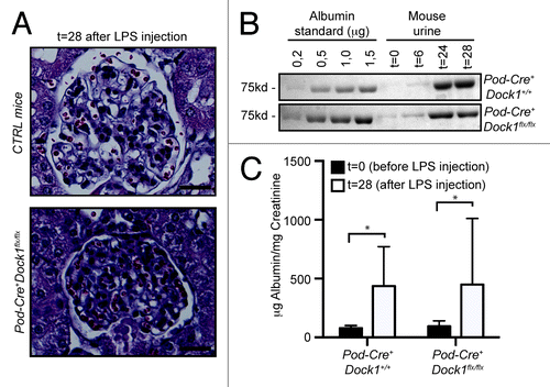 Figure 6. Loss of Dock1 expression in podocytes does not protect against LPS-induced proteinuria. (A) H&E-staining showing the glomerulus of 6 wk old Control and Pod-Cre+Dock1flx/flx female mice 28 h (t = 28) after LPS injection (Scale bar 20 μm, 40x). (B) LPS injection induces significant proteinuria in 6 wk old Pod-Cre+Dock1+/+ and Pod-Cre+Dock1flx/flx mice. Coomassie stained protein gel showing BSA standards (left) and the albumin content in the urine (right) collected from Pod-Cre+Dock1+/+ and Pod-Cre+Dock1flx/flx mice before (t = 0) and 6, 24 and 28 h (t = 6, t = 24, t = 28) after LPS injection. (C) Quantification of the average albumin-to-creatinine ratio in the urine of Pod-Cre-Dock1flx/flx and Pod-Cre+Dock1flx/flx before (t = 0) and 28 h (t = 28) after LPS injection.