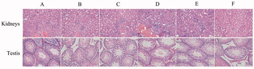 Figure 14. Histopathological images of kidneys and testis of different groups. The images presented are dedicated for (A) Normal (normal rats), (B) Model (RA rats without treatment), (C) Safety control (normal rats with Cel-Indo-NLCs-gel), (D) Cel-NLCs-gel (RA rats with Cel-NLCs-gel), (E) Indo-NLCs-gel (RA rats with Indo-NLCs-gel) and (F) Cel-Indo-NLCs-gel (RA rats with Cel-Indo-NLCs-gel) group.