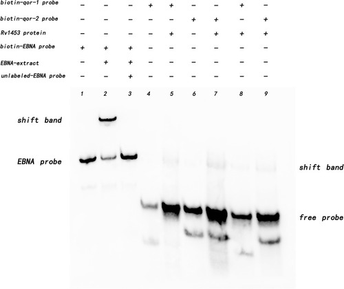 Figure 6 Rv1453 protein interacts with DNA segments from the promoter region of the qor gene.