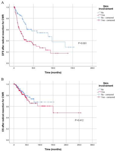 Figure 3. Kaplan–Meier curve for DFS and OS of 200 patients treated with radical resection stratified by skin involvement. (A) Kaplan–Meier curve for DFS stratified by skin involvement in 200 patients treated with radical resection. (B) Kaplan–Meier curve for OS stratified by skin involvement in these patients.