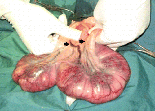 Figure 1.  Gravid uterus of rabbit; both branches of uterine artery have been closed for 3 and 9 minutes; colour changed but no remarkable change was observed from the third minute.