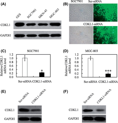 Figure 2. Infection of gastric cancer cells by CDKL1-siRNA-expressing lentivirus. (A) Analysis of CDKL1 protein in gastric cancer cell lines (GES, SGC7901, MKN45, MGC803) by Western blot assay. (B) The lentiviral vector containing CDKL1 siRNA or a scrambled sequence was constructed and respective lentivirus was packaged. SGC-7901 cells were infected with CDKL1 siRNA lentivirus or control lentivirus for three days and observed under fluorescence microscopy in bright field (left panel) and fluorescent field (right panel) with 400 × magnification. (C, D) Expression levels of mRNA were measured by qPCR. In comparison with control, CDKL1 siRNA lentivirus infection resulted in 76.4% and 82.2% decrease in the expression level of CDKL1 mRNA in SGC7901 (C) and MGC-803 (D) cells, respectively. (E, F) Expression levels of protein were measured by Western blot. CDKL1 protein was significantly downregulated in CDKL1 siRNA lentivirus infected SGC7901 (E) and MGC-803 (F) cells. *, p < 0.05 and ***, p < 0.001.