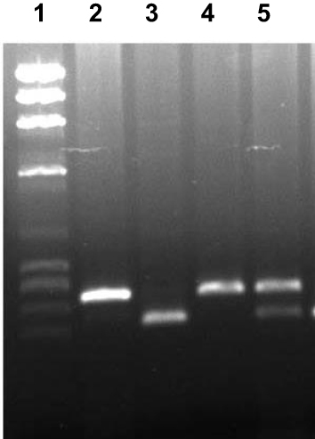 Figure 1 Detection of IL-4 gene (C590T) polymorphism genotypes. Lane 1, HaeII cleaved ϕX174 DNA Mr size markers; lane 2, un-cleaved PCR product; lane 3, PCR products cleaved with restriction enzyme BsmF1 from a subject with CC genotype; lanes 4, PCR products cleaved with restriction enzyme BsmF1 from a subject with TT genotype; lanes 5, PCR products cleaved with restriction enzyme BsmF1 from a subject with CT genotype.