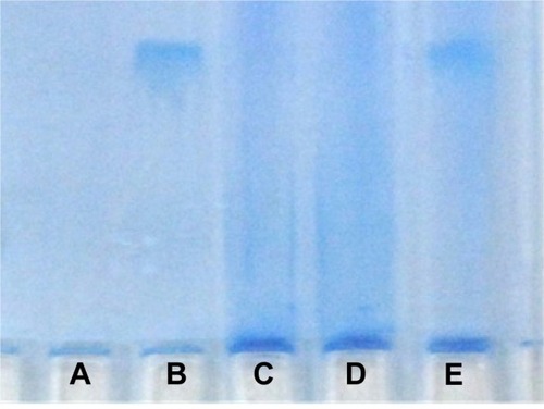 Figure 5 Polyacrylamide gel electrophoresis analysis.Notes: (A) Poly(aminoethyl ethylene phosphate)/poly(L-lactide) (PAEEP-PLLA) nanobubbles (NBs), (B) free lactoferrin (Lf), (C, D) Lf-conjugated PAEEP-PLLA NBs, and (E) a mixture of free Lf and PAEEP-PLLA NBs.