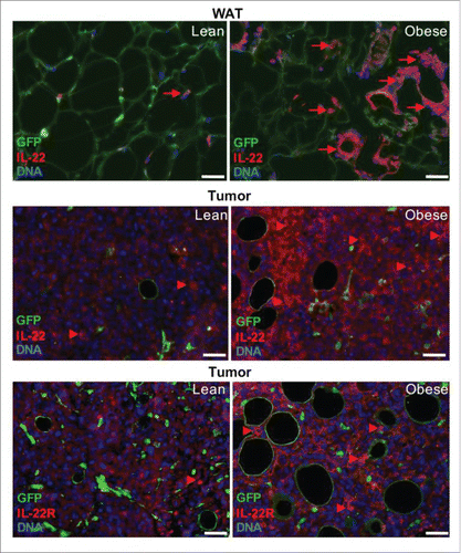 Figure 1. The IL-22 / IL-22R axis in obesity and cancer. Analysis of tissues from lean and obese mice reveals that in WAT IL-22 expression by infiltrating leukocytes is increased in obesity (arrows) and that in tumors IL-22 signal is associated with tumor cells and that IL-22R expression by tumor cells is increased in obesity (arrowheads). Mesenchymal and endothelial cells are GFP-positive; leukocytes and malignant cells are GFP-negative. The experiment was performed in C57BL/6-Tg(UBC-GFP)30Scha/J mice that had received a bone marrow transplant from B6.Cg-Tg(ACTB-mRFP1)1F1Hadj/J mice as described.Citation8,44 Mice had been fed with chow (lean) or 58 kcal% (fat) diet to induce DIO for 4 months (obese). EO771 cells were then grafted into the mammary fat pad and tumors were allowed to form. Formalin-fixed paraffin-embedded tissues were sectioned and analyzed by immunofluorescence as describedCitation49,50 using anti-IL-22 bs-2623R (Bioss, 1:100) and anti-IL-22R bs-2624R (Bioss, 1:200) antibodies, followed by secondary Alexa 488-conjugated and Cy3-conjugated antibodies. Nuclei were visualized with DAPI staining. Scale bar, 50 µm.