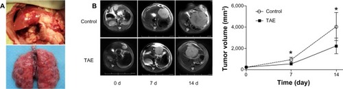 Figure 3 Orthotopic liver tumor model and the comparison of tumor size between the TAE group and the control group.