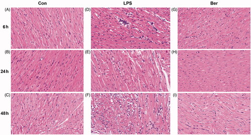 Figure 2. Histological changes of the myocardial tissue assessed by H&E staining. (A, B, C) Histopathological features of the myocardial tissue in the Con group at 6, 24, and 48 h. (D, E, F) Cardiomyocytes were swollen and enlarged, with infiltrated lymphocytes emerging in the LPS group at 6, 24, and 48 h. (G, H, I) Histopathological features of the myocardial tissue in the Ber group at 6, 24, and 48 h. Magnification, 200X.