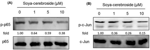 Figure 6. Soya-cerebroside inhibits activation of NF-κB and AP-1. RASFs were incubated with soya-cerebroside (1–10 μM) for 24 h. p65 and c-Jun phosphorylation was examined by Western blot analysis.
