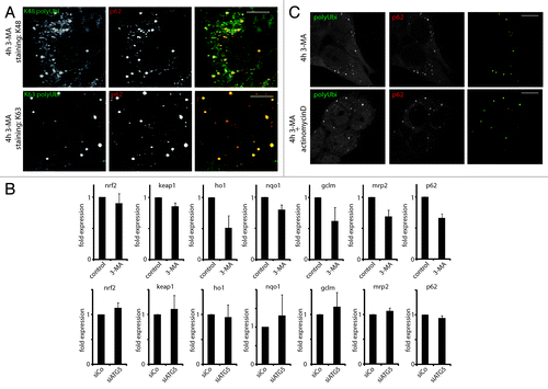 Figure 3. ALIS contain different linkage type polyubiquitin, and form independently of NRF2 signaling and general transcription. (A) HeLa cells were treated for 4 h with 3-MA and stained for the indicated ubiquitin linkage type (K48 and K62 polyUbi, green) and p62 (red). (B) HeLa cells were treated or not for 4 h with 3-MA (top), or transfected with siRNA against ATG5 (siATG5) or nontargeting siRNA (siCo), and qPCR for the indicated genes was carried (mean ± SEM from three independent experiments). (C) HeLa cells were treated or not for 4 h with 3-MA in the presence or absence of Actinomycin D. Cells were stained for ubiquitinated protein (FK2 antibody, polyUbi, green) and p62 (red). Bar, 10 µm.