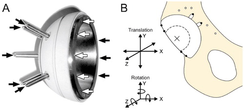 Figure 1. A. The custom-modified acetabular cup with 8 RSA beads (arrows) inserted in the opening and additional RSA beads inserted at the tips of the 5 fixation spikes of the cup. B. The anatomical orientation of the coordinate system used to evaluate the translational and rotational migration of the cup.