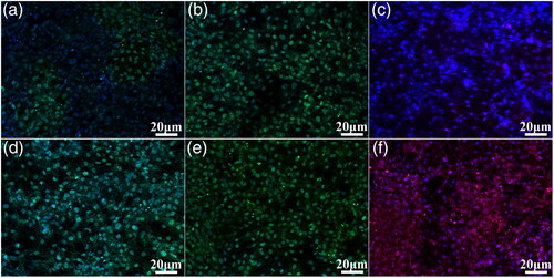 Figure 7. Immunofluorescence detection of SaOS-2 cells grow on the MAO coating: OPN (a), Col-I (b), and OCN (c); and the MHTZn coating: OPN (d), Col-I (e), and OCN (f) for 14 days.