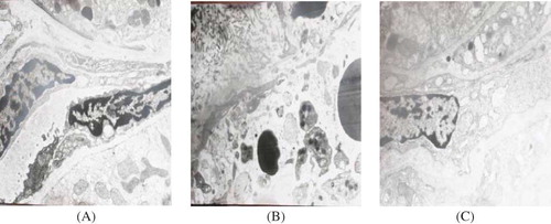 Figure 2. Electron microscopy in tissue samples (×10,000). (A) Control group at day 7. The ultrastructure of PTC endothelial cells was normal. (B) Model group at day 7. PTC endothelial cell membrane was partially damaged, and the partial separation of endothelial cells from the glomerular basement membrane was observed. (C) PGE1 group at day 7. PTC endothelial cells cytoplasmic swelling was seen, but no rupture of endothelial cells was observed.
