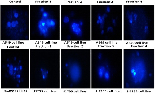 Figure 6. Zoomed pictures of the nuclei of the control and fraction treated two cell lines showing typical features of apoptosis which include chromatin condensation, nuclear shrinkage and the formation of apoptotic bodies.