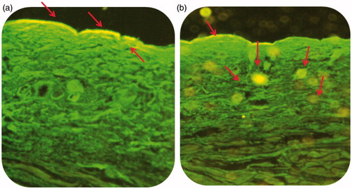 Figure 5. Confocal laser scanning photomicrographs of fixed skin sections after treatment with (a) 6-coumarin-loaded hydrogel and (b) 6-coumarin-loaded liposomal gel.