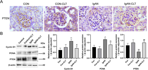 Figure 6 Celastrol upregulated PTEN signaling in the kidney of IgAN mice. (A) Representative images of glomerular immunohistochemical staining with PTEN in Celastrol treated mice or control mice. Bars=50μm. Images were captured at ×400 magnification. (B) Western blot and gray value statistics of PTEN, Cyclin D1 and, PCNA in renal cortex tissue samples. All data presented as mean ± SD, n=6. *p < 0.05 vs control group, **p < 0.01 vs control group, #p < 0.05 vs IgAN group, ##p < 0.01 vs IgAN group, ns: p> 0.05 vs Control OR IgAN group.