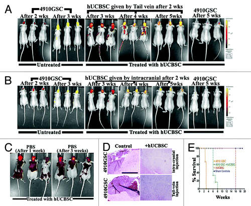 Figure 5. Homing of hUCBSC toward tumors in the mice brains. 4910 GSC (250,000 cells) were injected into the brains of athymic nude mice by intracranial administration. After 2 weeks, hUCBSC (250,000 cells) were injected into either (A) the tail vein or (B) intracranially (contra-lateral) and observed for 3 weeks. From the 2nd week until the end of the 5th week, mice were subjected to in vivo imaging using the IVIS Imaging System (n = 6 for each group). (C) Mice brains were injected with 10 µL of sterile PBS by intracranial administration. After 1 week, labeled hUCBSC (250,000 cells) were injected by through the tail vein and observed for homing by in vivo imaging; n = 3. (D) The brain sections of mice (A, B) were checked for the presence of tumor formation by H&E staining; bar = 500 µm; n = 3. (E) Survival curves were plotted for control and treated mice.