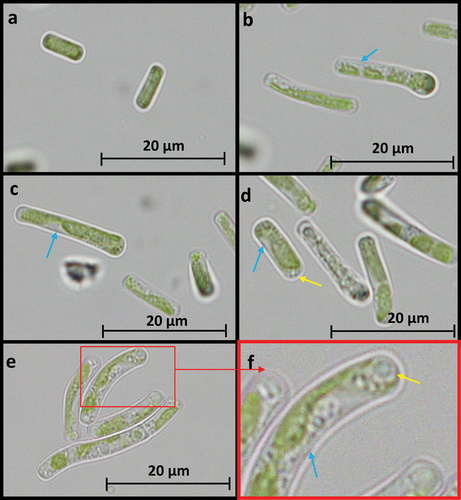 Figure 2. Morphological image of Tetratostichococcus sp. P1 under a microscope at 100× magnification. (a) morphology under control. (b) Morphology under 10 µM of Cd. (c) Morphology under 20 µM of Cd. (d) Morphology under 50 µM of Cd. e - f. morphology under 100 µM of Cd. Yellow arrow showing vacuole-like organel. Blue arrow showing non green part of the cell. The picture was taken after 6 days of cultivation.