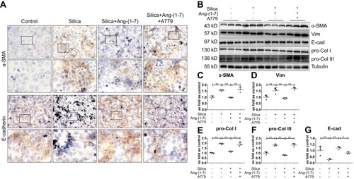 Figure 7 Ang-(1–7) inhibits SiO2-induced EMT in MLE-12 alveolar type II epithelial cells. (A) Immunohistochemistry staining of α-SMA and E-cad expression in silica-treated MLE-12 cells. Magnification, ×40 (top panels) and ×200 (bottom panels). (B) Western blot showing the protein expression of α-SMA (C), Vim (D), pro-Col I (E), pro-Col III (F), and E-cad (G) in these cells. Silica-treated MLE-12 underwent various treatment combinations with Ang-(1–7), and A779 (Mas receptor blocker). Values represent the mean ± SD, n = 3 independent experiments, fold change is expressed relative to the control (no treatments), *P < 0.05 vs corresponding group, **P < 0.01 vs corresponding group.