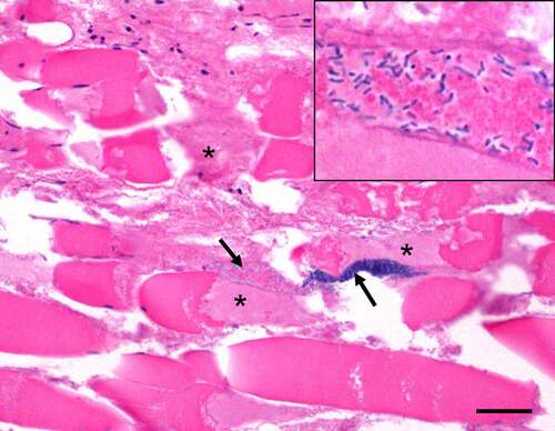 Figure 4. Gas gangrene by C. perfringens type A in an experimentally infected mouse. This animal was challenged with 109 washed vegetative cells of C. perfringens strain 13 and euthanized 4 h later. There is severe skeletal muscle necrosis (asterisks) and myriad intralesional bacilli (arrows and insert). Notice that there is minimal inflammatory infiltrate. Hematoxylin and eosin. Scale bar = 50 μm