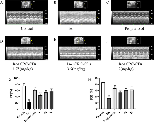 Figure 4 The echocardiographic results showed that pretreatment with CRC-CDs increased the levels of EF and FS in rats. (A) Control group. (B) Iso group. (C) Propranolol group. (D) Low-dose CRC-CDs group. (E) Medium-dose CRC-CDs group. (F) High-dose CRC-CDs group. (G) Left ventricular ejection fraction of rats in each group. (H) Left ventricular shortening fraction in all groups of rats. Date are represented as means ± SD (n = 8). ##P < 0.01 compared with the control group, **P < 0.01 compared with the Iso group.