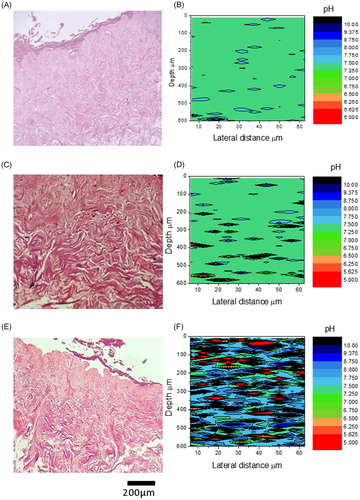 Figure 6. Measurement of pH in bacterially infected skin. H&E sections (A, C, & E) and pH plots (B, E, & F) of sections through control TE-skin (A&B), S. aureus infected (C&D), and P. aeruginosa infected (E & F) TE-skin. ×100 magnification, scale bar represents 200 µm, n = 3.